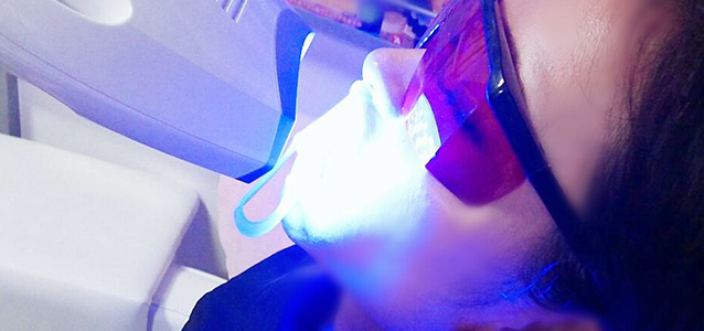 SelfWhitening